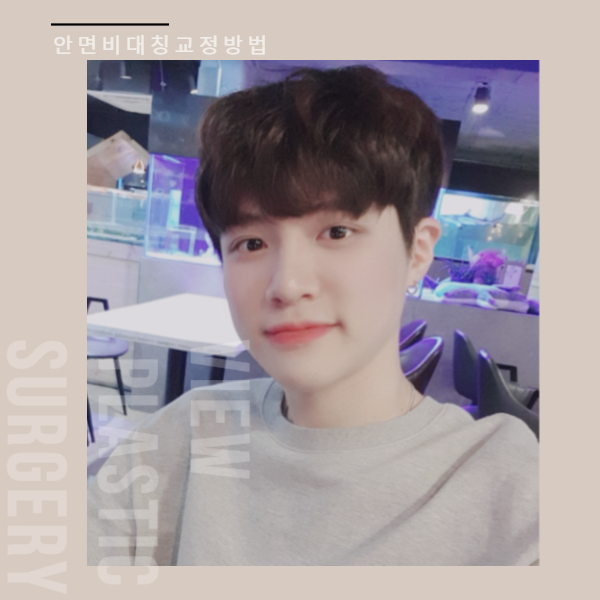 안면비대칭교정방법 자세히 알고 싶다면 관련 이미지 11