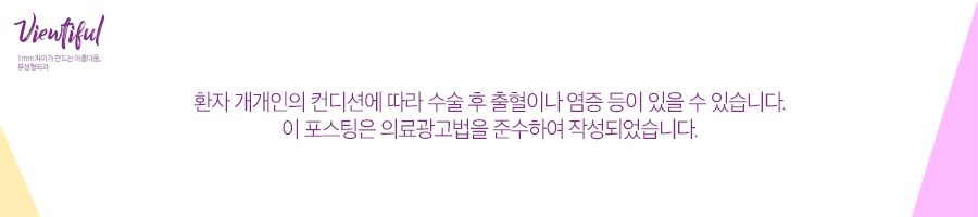 '윤곽3종' 의 뜻 = 인형라인 VS 네추럴라인 비교 관련 이미지 8