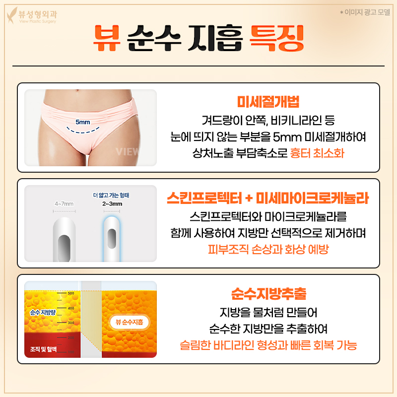 단기간내 눈에 띄는 지방 감량 방법, 지방흡입 관련 이미지 2