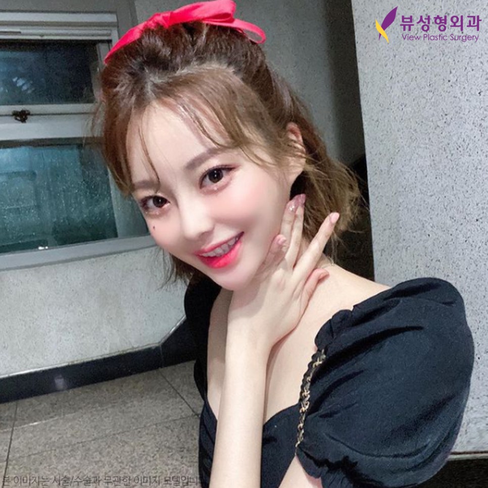 쌍수후기 좋은 눈수술잘하는곳! l 뷰성형외과 관련 이미지 2