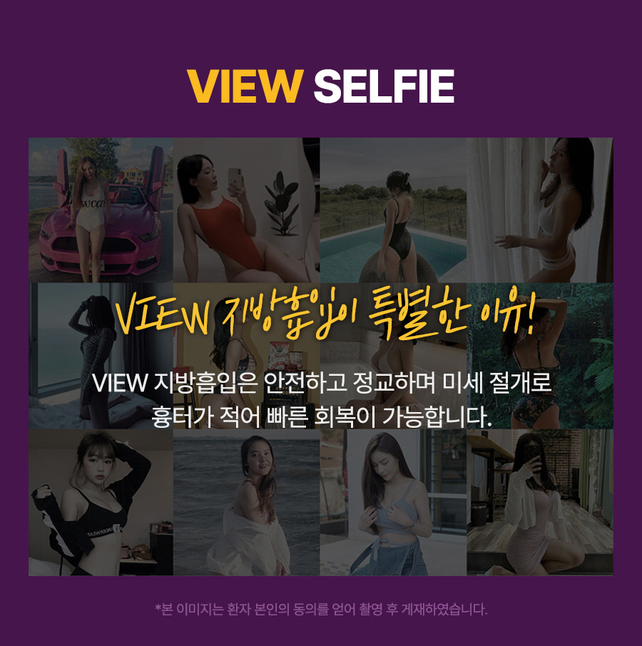 단기간내 눈에 띄는 지방 감량 방법, 지방흡입 관련 이미지 4