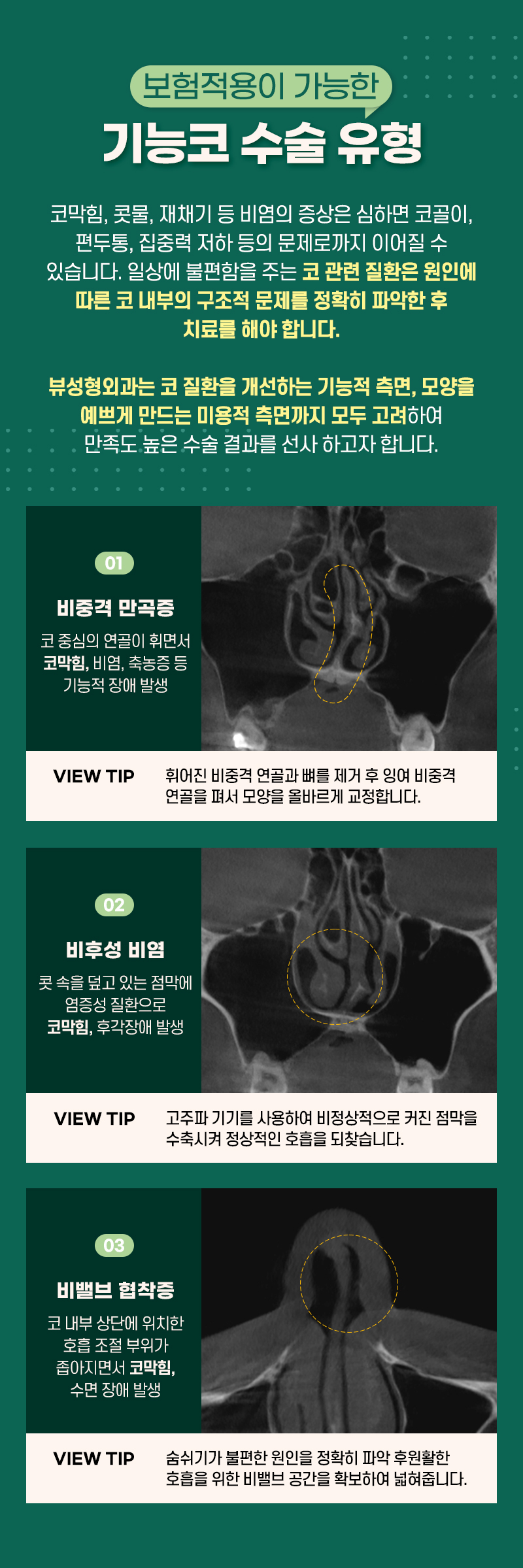 코수술비용, 합리적인 곳을 찾는다면 관련 이미지 3