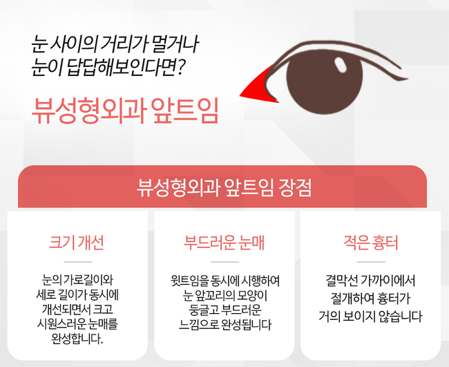 뷰성형외과 트임성형수술로 예쁨 충전 완료&hearts; 관련 이미지 5