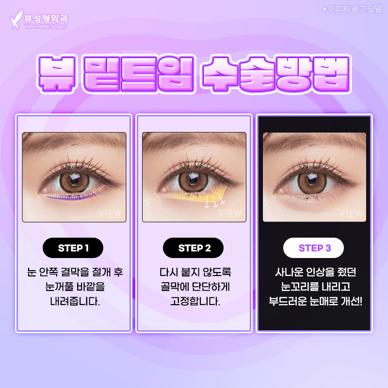 뒷트임밑트임후기로 강아지눈매 자랑해보자고! 관련 이미지 5