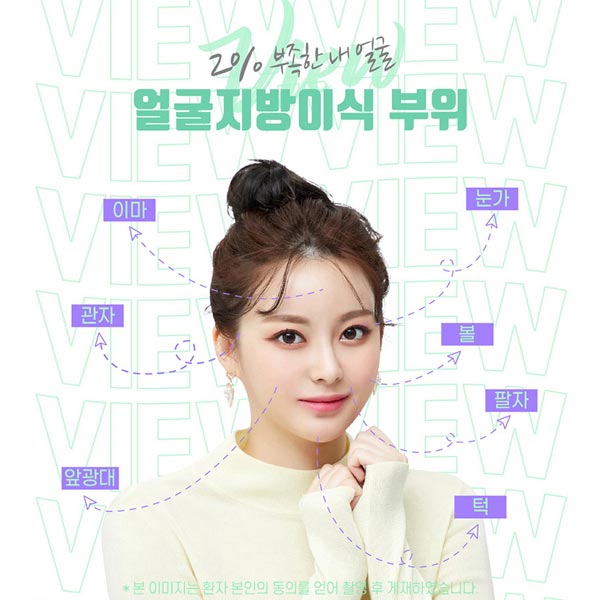 팔자주름지방이식 으로 젊어지자! 관련 이미지 5