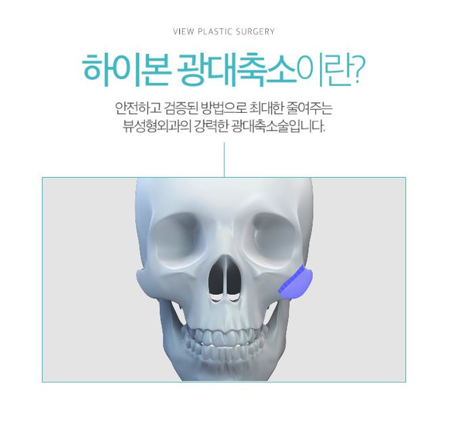 옆광대축소 작은얼굴 바란다면 관련 이미지 3