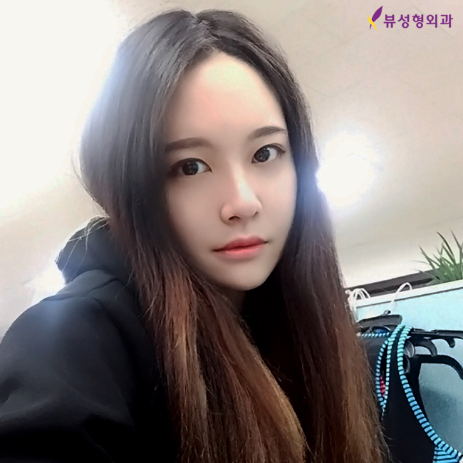 믿고보는 뷰성형외과 코성형후기★ 관련 이미지 5