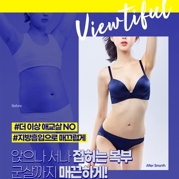 지방흡입후관리 왜 중요할까? 관련 이미지 3