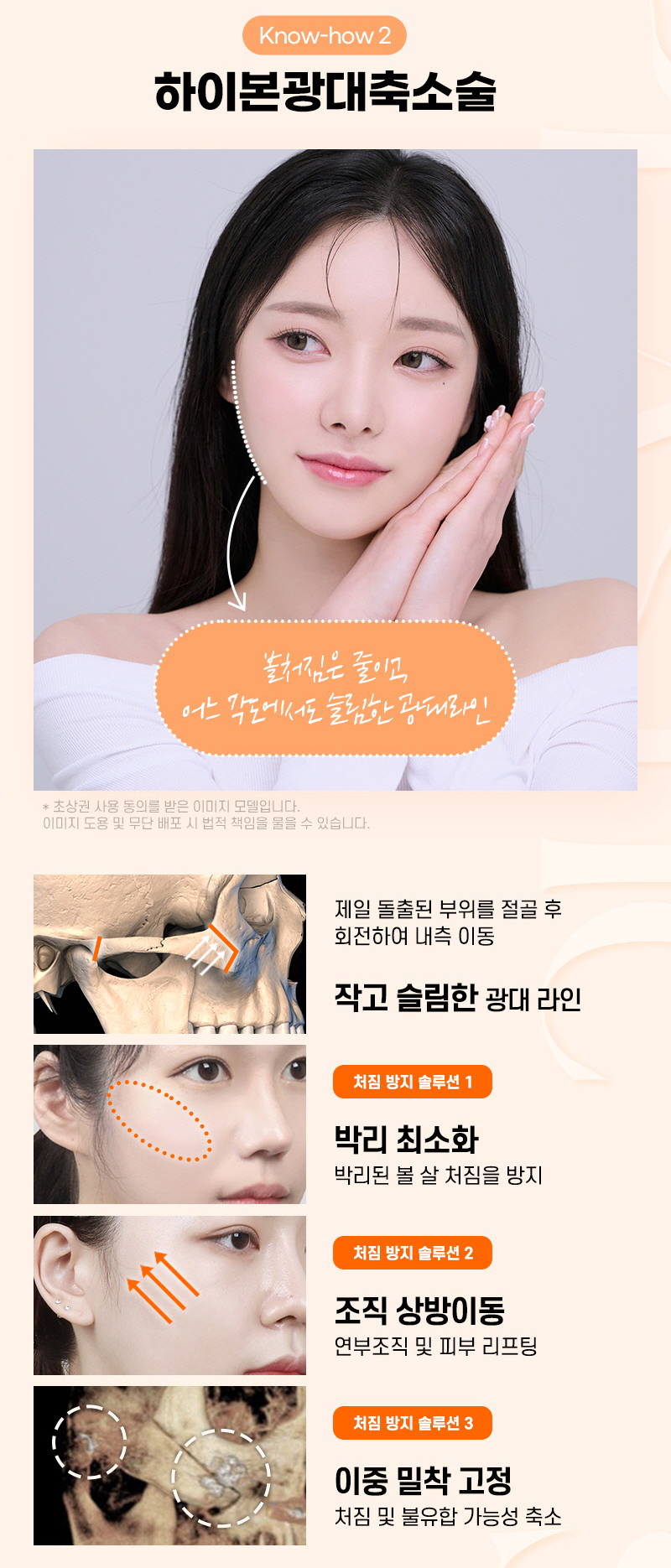 얼굴 밸런스 개선으로 예쁜 얼굴형 만들기, 윤곽3종 관련 이미지 5