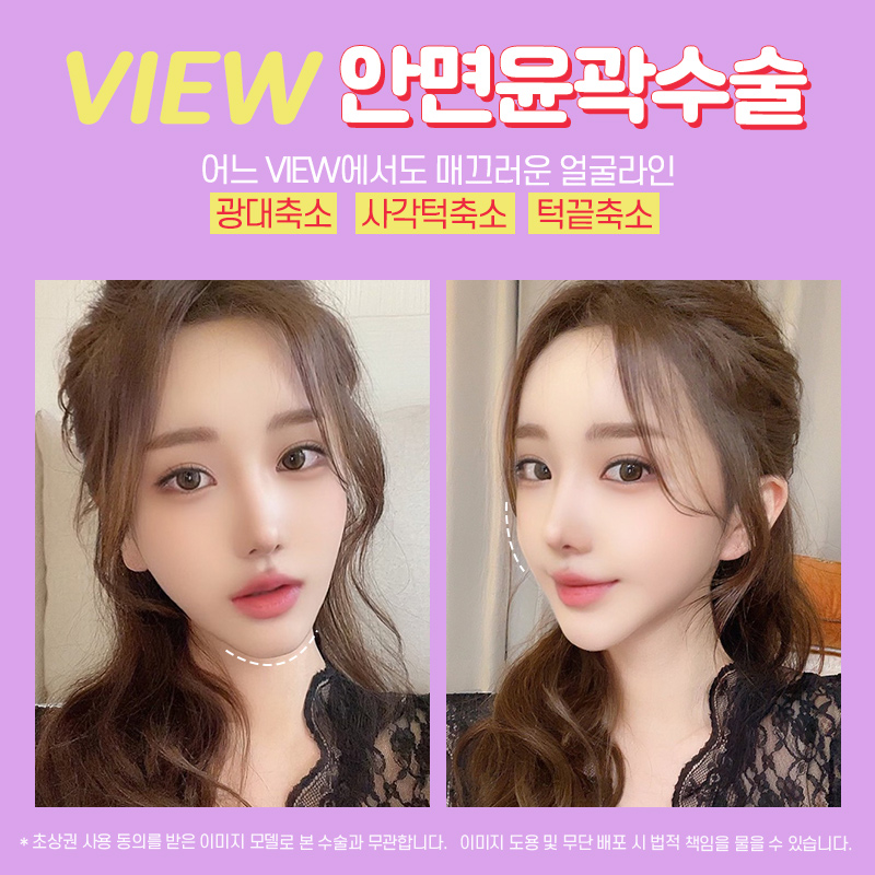 안면윤곽후기 뼈 상태를 위주로 관련 이미지 5