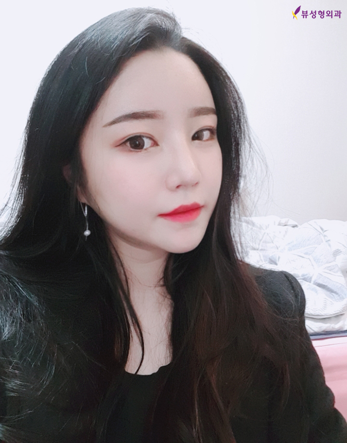 안면윤곽성형 황금비율 찾는 사각턱성형이 필요해 관련 이미지 7