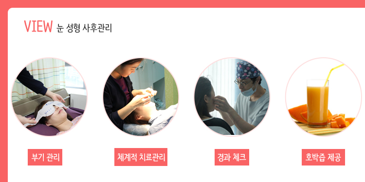 뷰 눈성형 사후관리는 어떨까? 관련 이미지 3