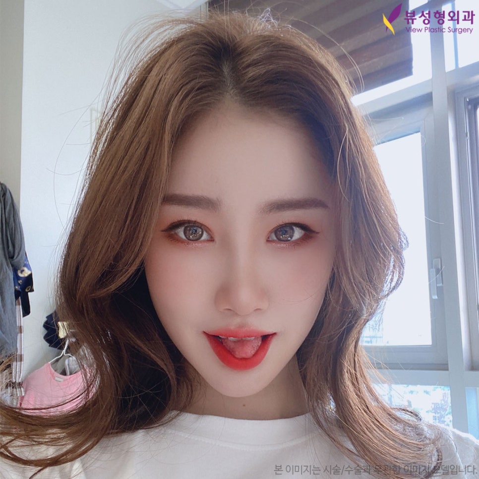 안면윤곽수술회복기간 제대로 알아보자 관련 이미지 6