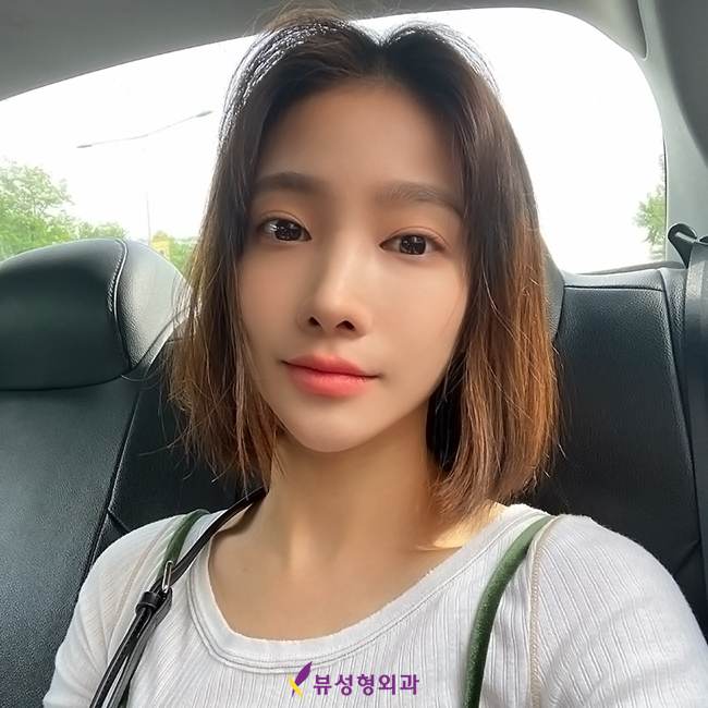 옆광대축소 작은얼굴 바란다면 관련 이미지 11