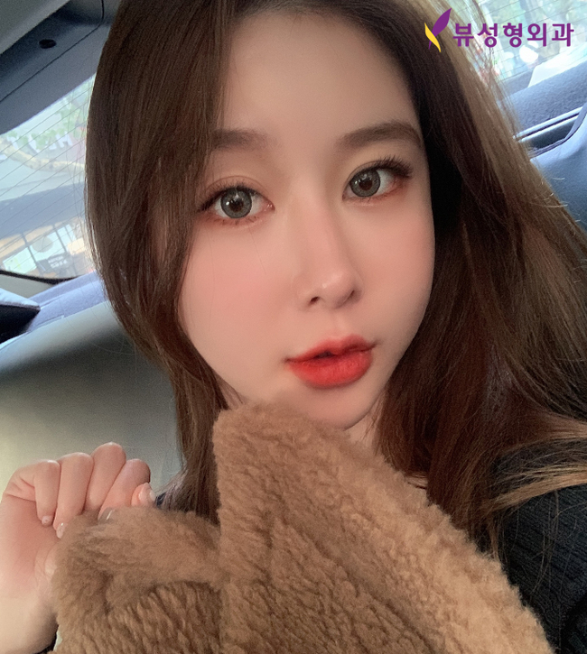 젊음의비결! 부분거상술 상안검/하안검 선택하세요 관련 이미지 5