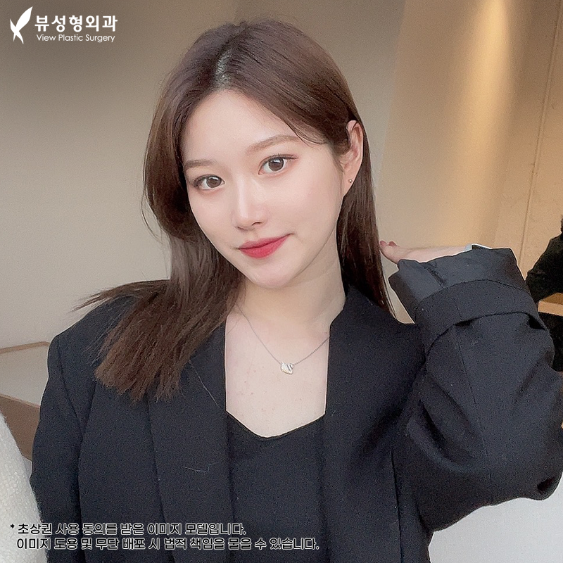 기능코성형, 누군가에겐 꼭 필요한 성형 관련 이미지 8