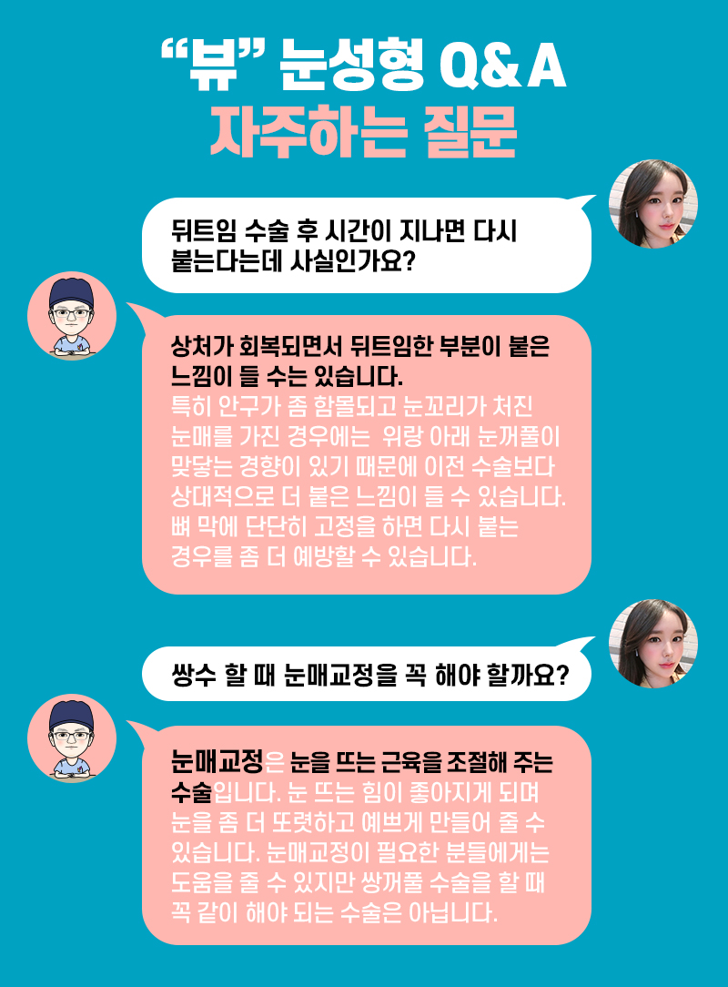 눈성형외과 중요한 점부터 관련 이미지 6