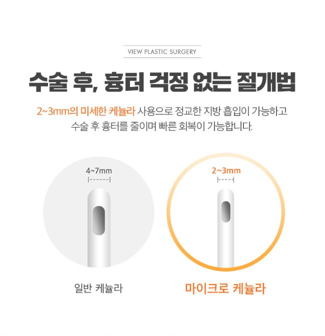 팔뚝지방흡입 슬림한 바디라인 뷰성형외과라면 관련 이미지 5
