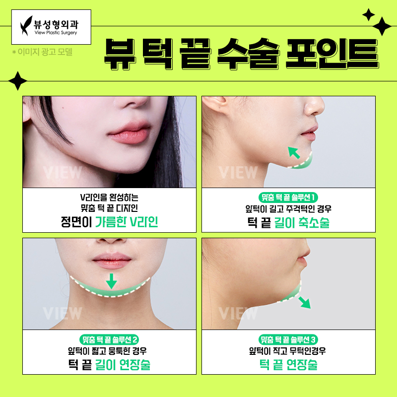 얼굴형의 밸런스를 맞춰주는 안면윤곽수술 관련 이미지 10