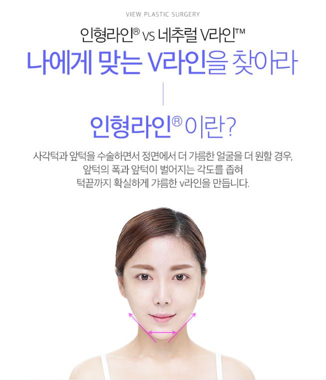안면윤곽성형외과 보다 나아진 인상을 관련 이미지 3