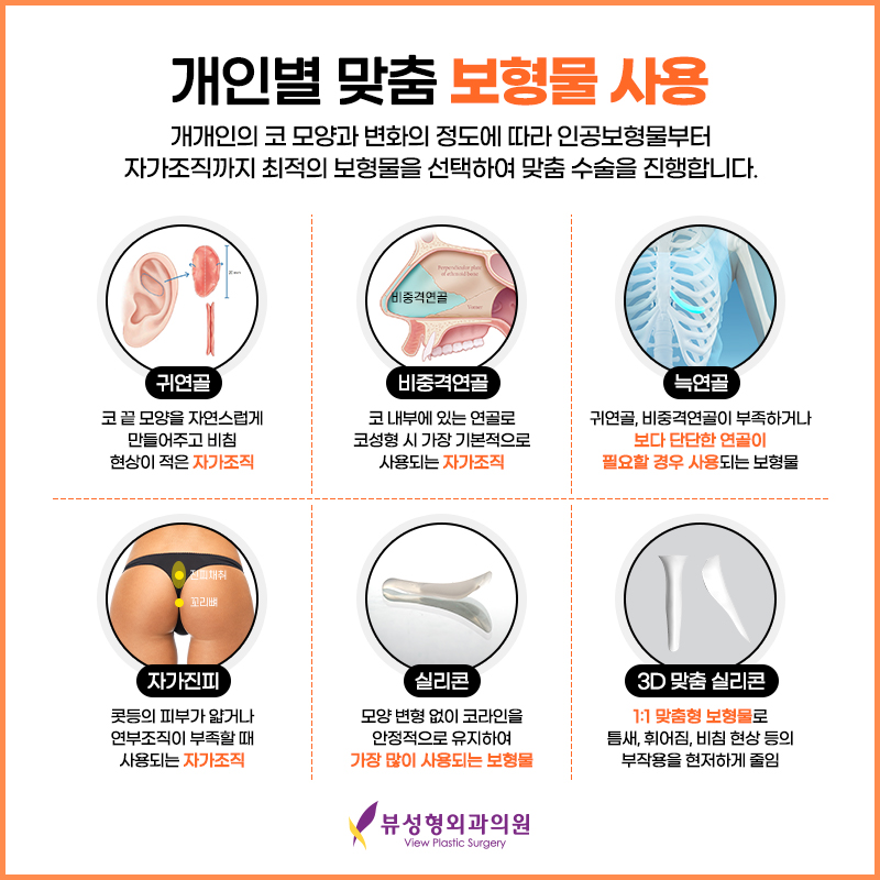 예술적인 코라인부터 비염수술까지 잘하는 뷰성형외과 관련 이미지 5