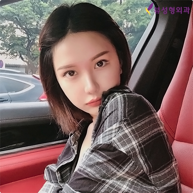 뷰성형외과 매부리코교정, 포인트는? 관련 이미지 4