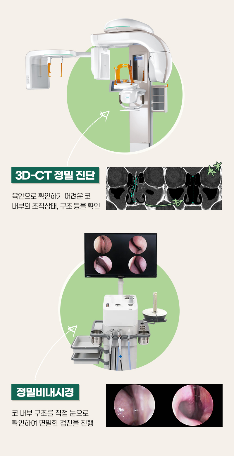 기능코성형 원인과 필요성을 고려하는 뷰성형외과에서 관련 이미지 8