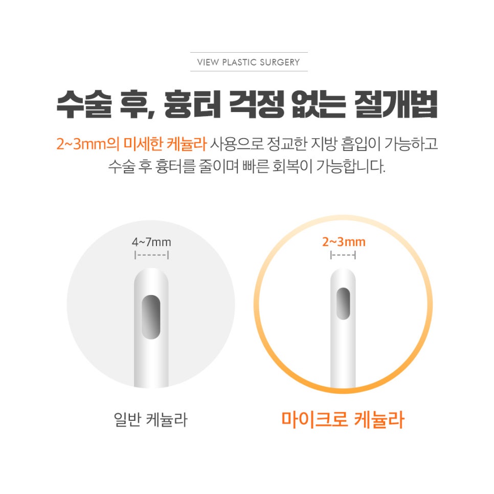 전신지방흡입, 라인과 탄력 그리고 안전까지! 관련 이미지 5