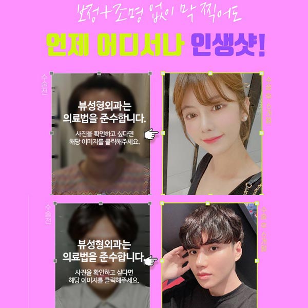 안면비대칭교정방법 자세히 알고 싶다면 관련 이미지 3