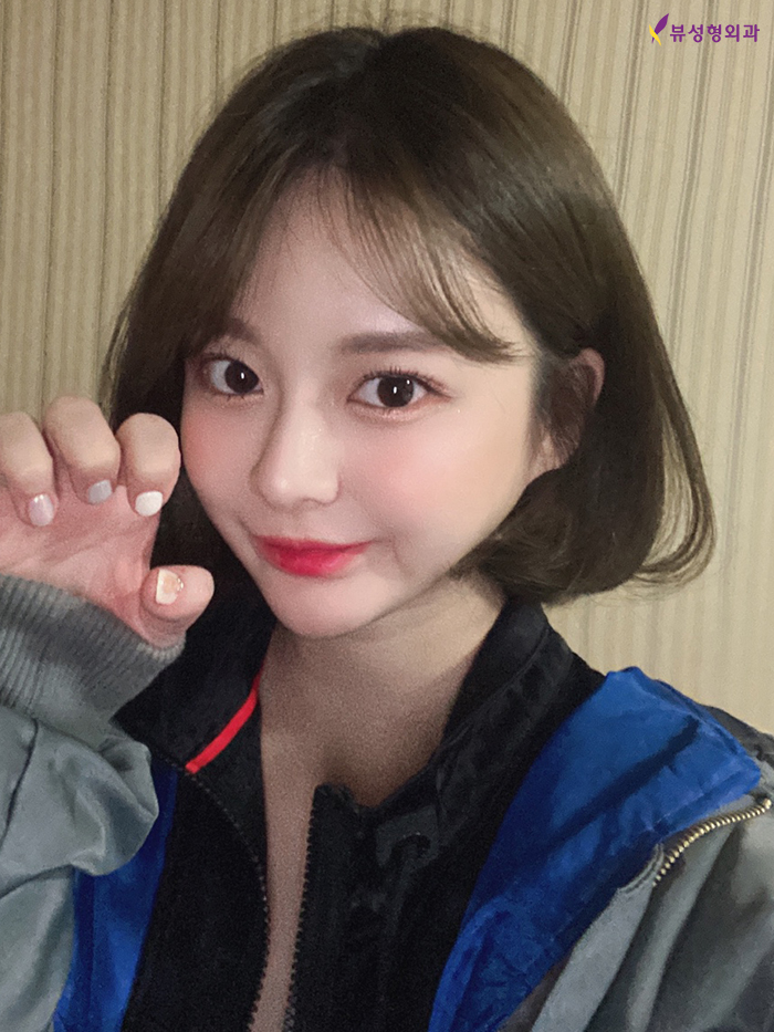 안면윤곽성형 황금비율 찾는 사각턱성형이 필요해 관련 이미지 6