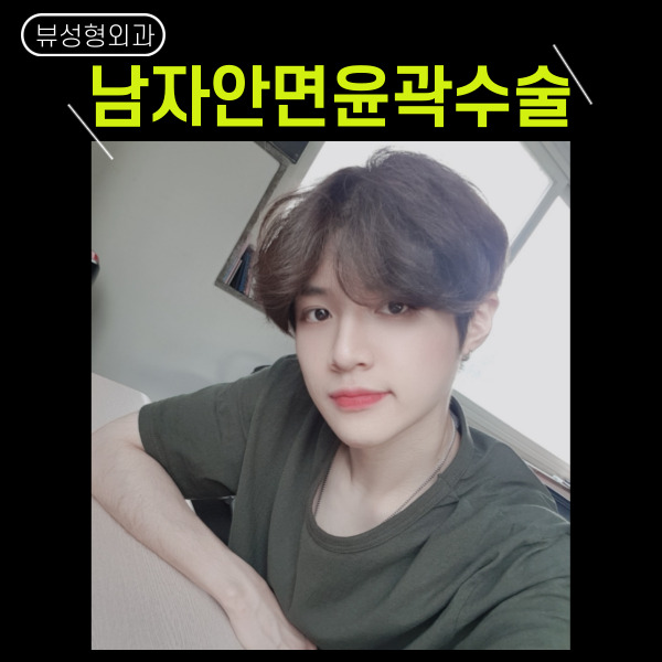 남자안면윤곽수술 의 핵심은! 관련 이미지 5