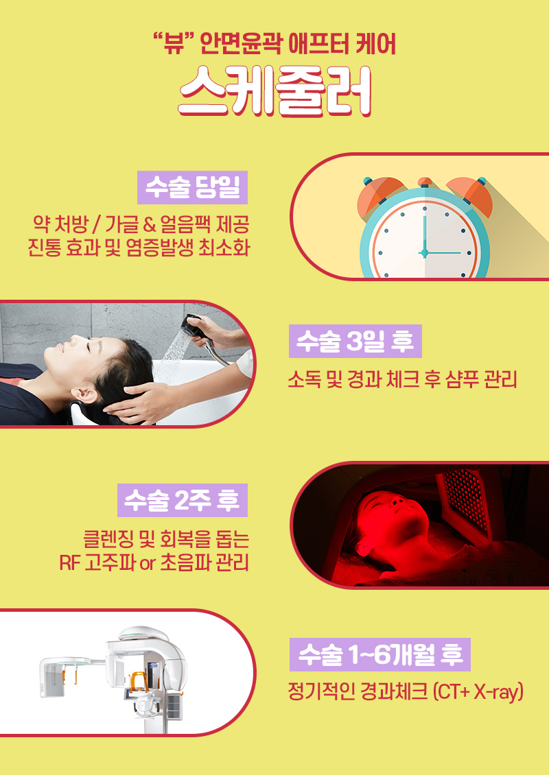 안면윤곽후기 뼈 상태를 위주로 관련 이미지 4