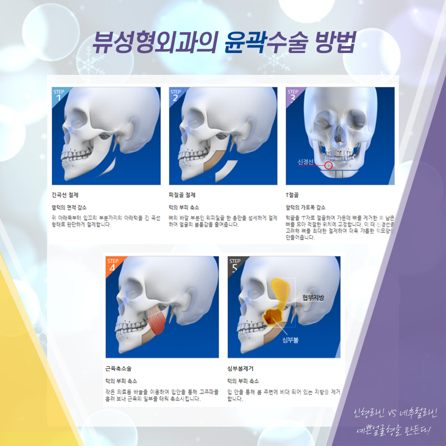 '윤곽3종' 의 뜻 = 인형라인 VS 네추럴라인 비교 관련 이미지 5