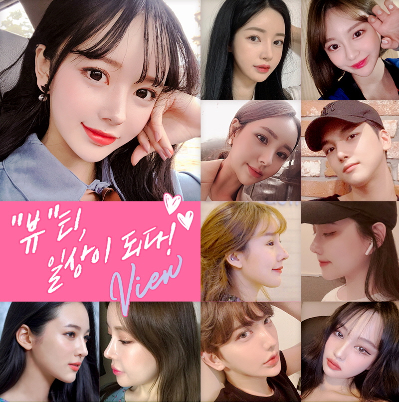 코성형, 개인별 유형에 적합한 수술방법은? 관련 이미지 24