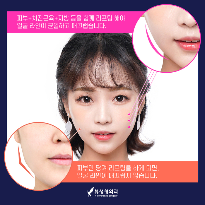 실리프팅 VS 안면거상술, 피부 상태에 맞는 맞춤리프팅 관련 이미지 14