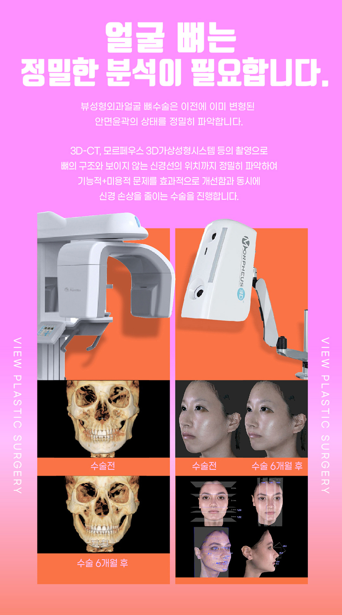 예뻐지는 수술? 양악수술의 올바른 정보 관련 이미지 9
