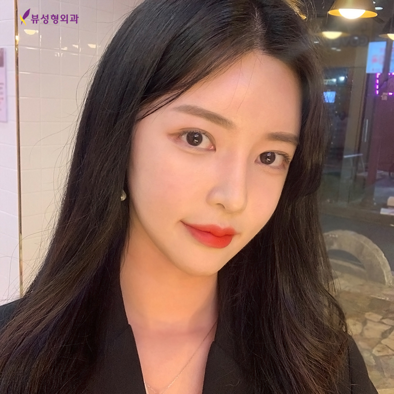 자연스럽게 윤곽잘하는곳 뷰성형외과 관련 이미지 8