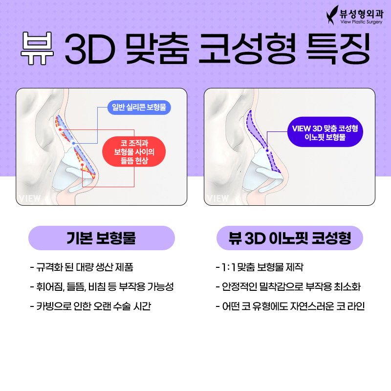 저는 매부리코로 만들어주세요 (?) 관련 이미지 2