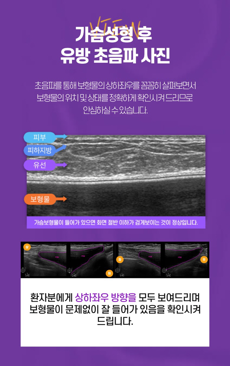 체계적인 유방검진 시스템, 예쁘고 건강한 가슴은 뷰성형외과 관련 이미지 8