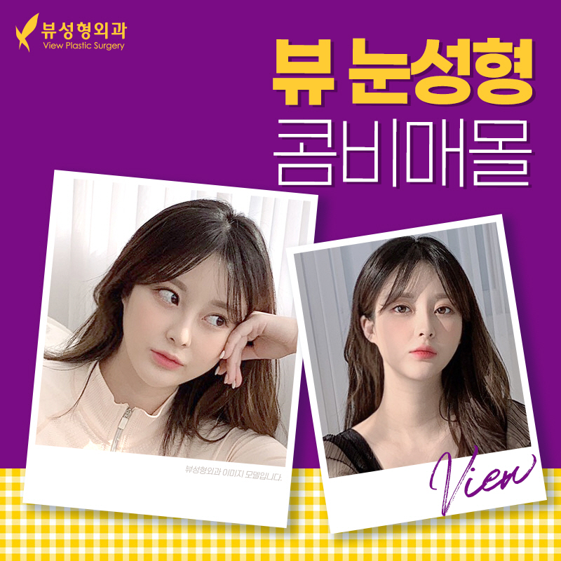 쌍꺼풀수술비용, 목적에 맞춰서 관련 이미지 1