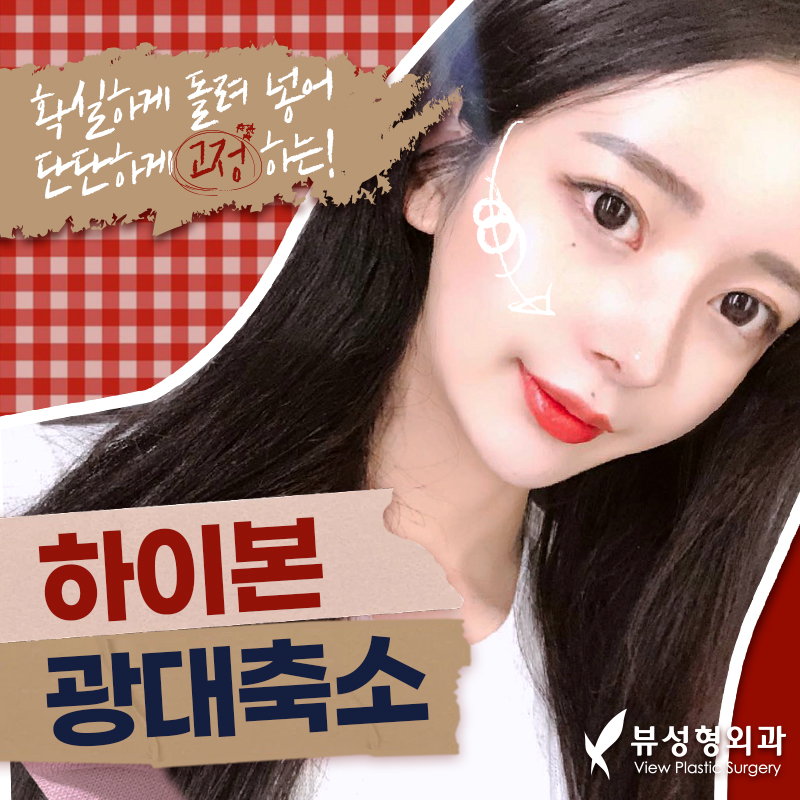 얼굴형의 밸런스를 맞춰주는 안면윤곽수술 관련 이미지 4