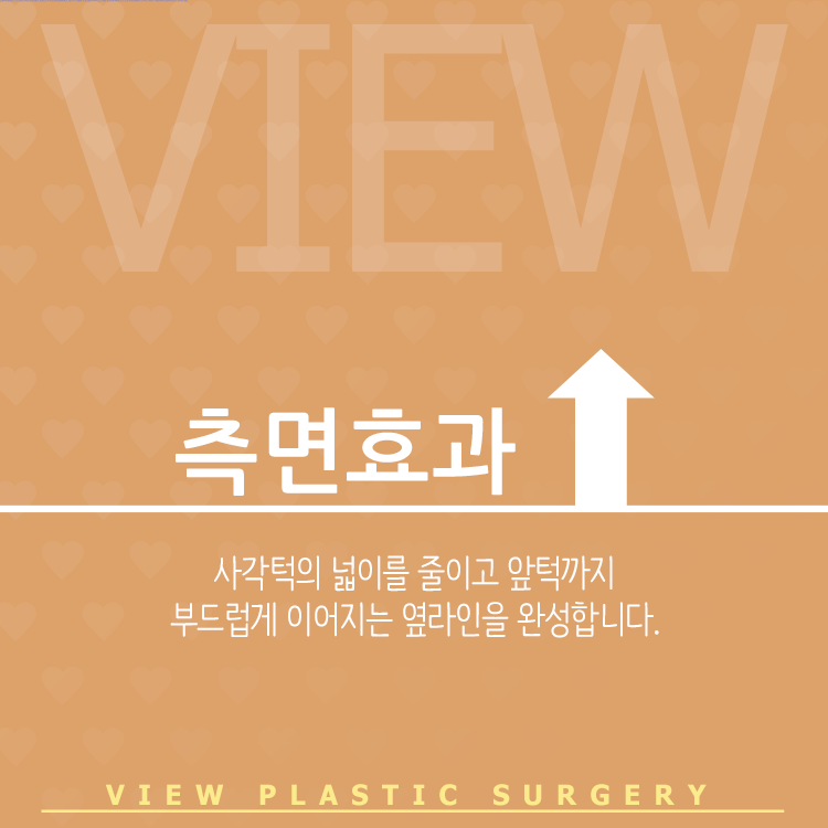 얼굴의 완성은 윤곽수술로! 관련 이미지 3