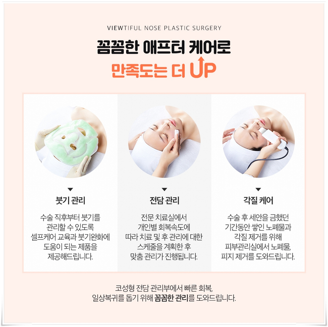 뷰성형외과 코성형종류 나에게 적합한 방법은? 관련 이미지 8
