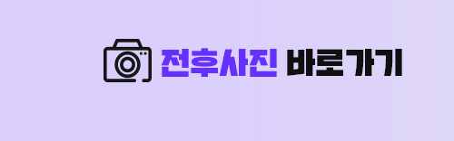 얼굴의 비율과 균형, 조화를 이루는 코성형 관련 이미지 6