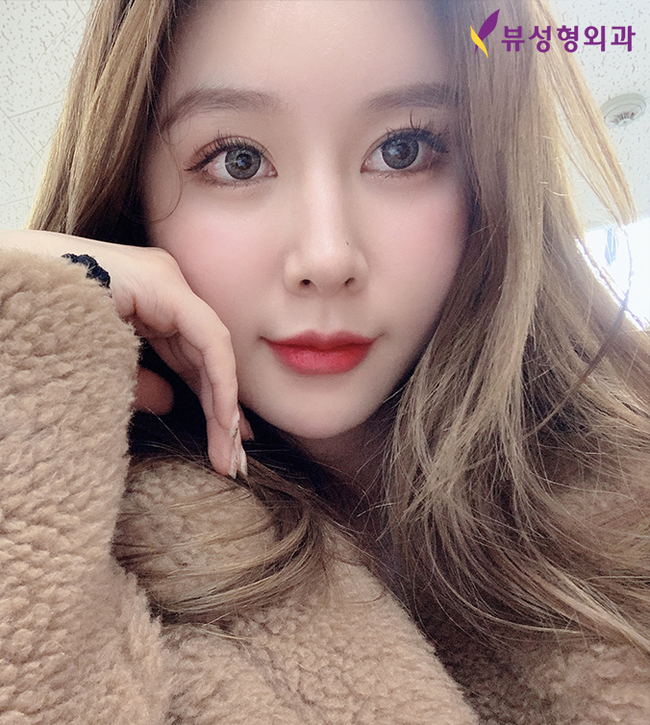 젊음의비결! 부분거상술 상안검/하안검 선택하세요 관련 이미지 4