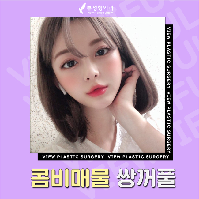 매몰법잘하는곳 뷰성형외과 콤비매몰이라면 관련 이미지 1