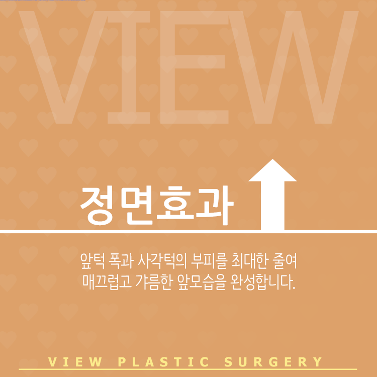 얼굴의 완성은 윤곽수술로! 관련 이미지 2