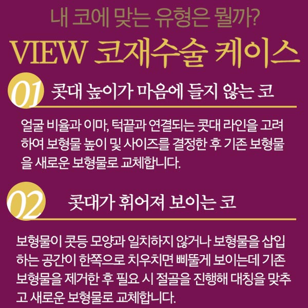코재수술성형외과 찾고있다면 뷰성형외과로 관련 이미지 7