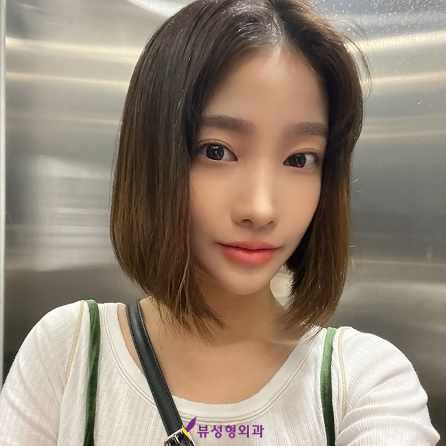 옆광대축소 작은얼굴 바란다면 관련 이미지 10