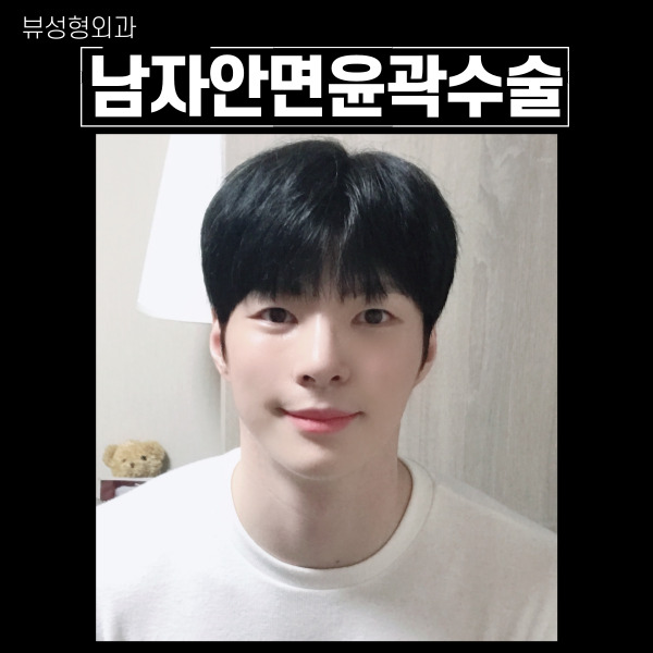 남자안면윤곽수술 의 핵심은! 관련 이미지 9